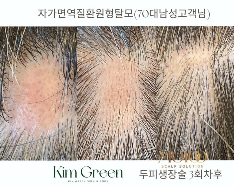 오늘헤어 이미지