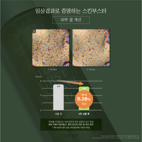 탑퍼스트 이미지