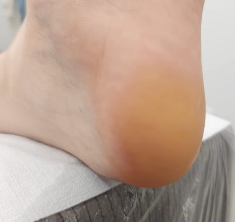 대전눈썹페이스터치&어나더블랙대전지사 이미지