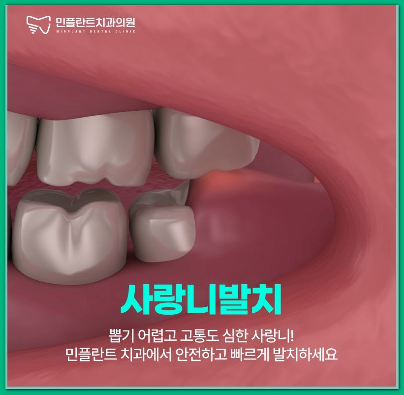 민플란트치과의원 이미지