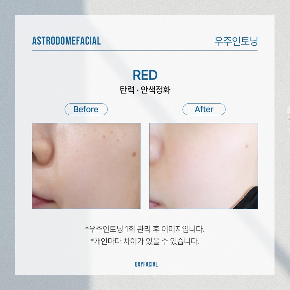 산소피부과의원 이미지