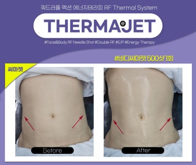 타이팅 메디케어 스킨앤바디 이미지