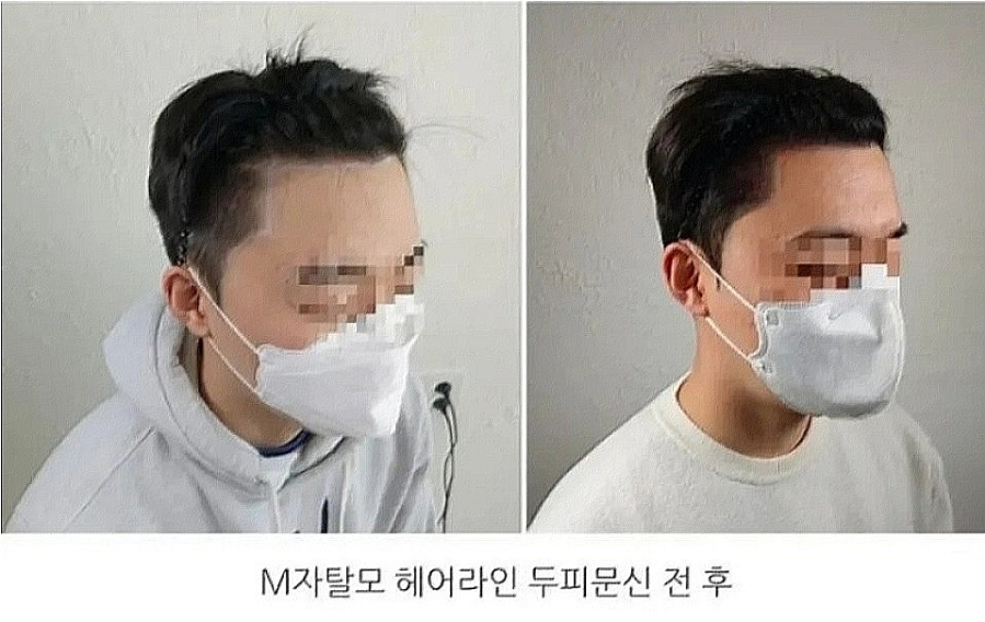 헤드라인유 이미지