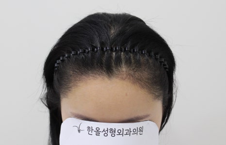 더헤어라인성형외과의원 이미지