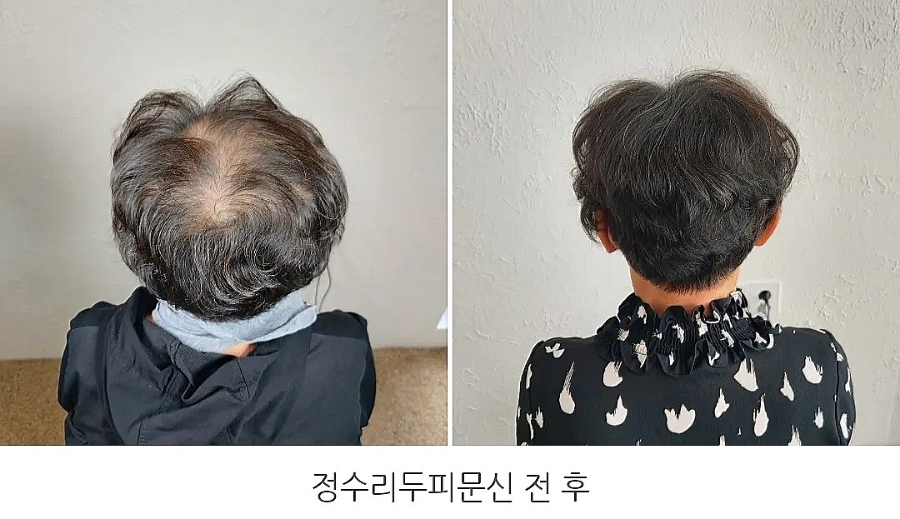 헤드라인유 이미지
