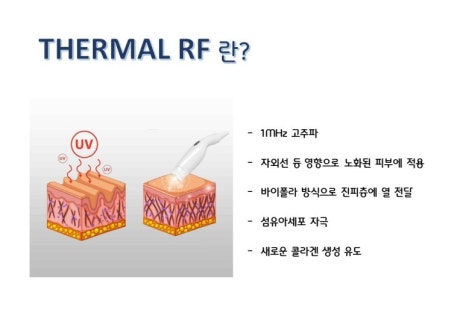 플라즈마 에스테틱 이미지