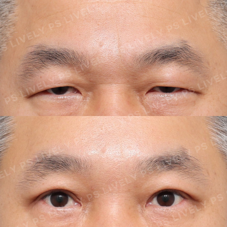 라이블리성형외과의원 이미지