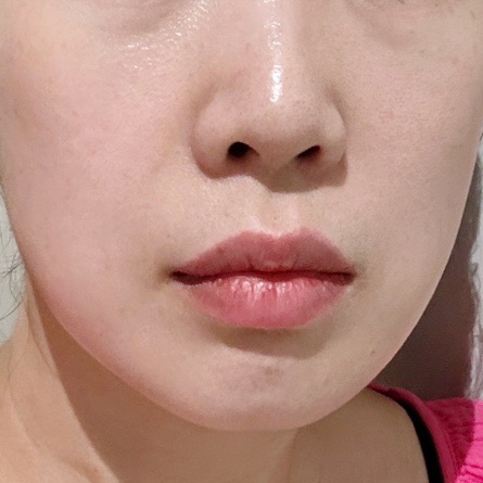 세르모소에스테틱 이미지