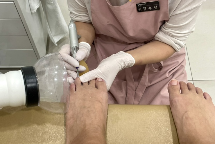내성발톱발톱무좀관리김수정뷰티 이미지