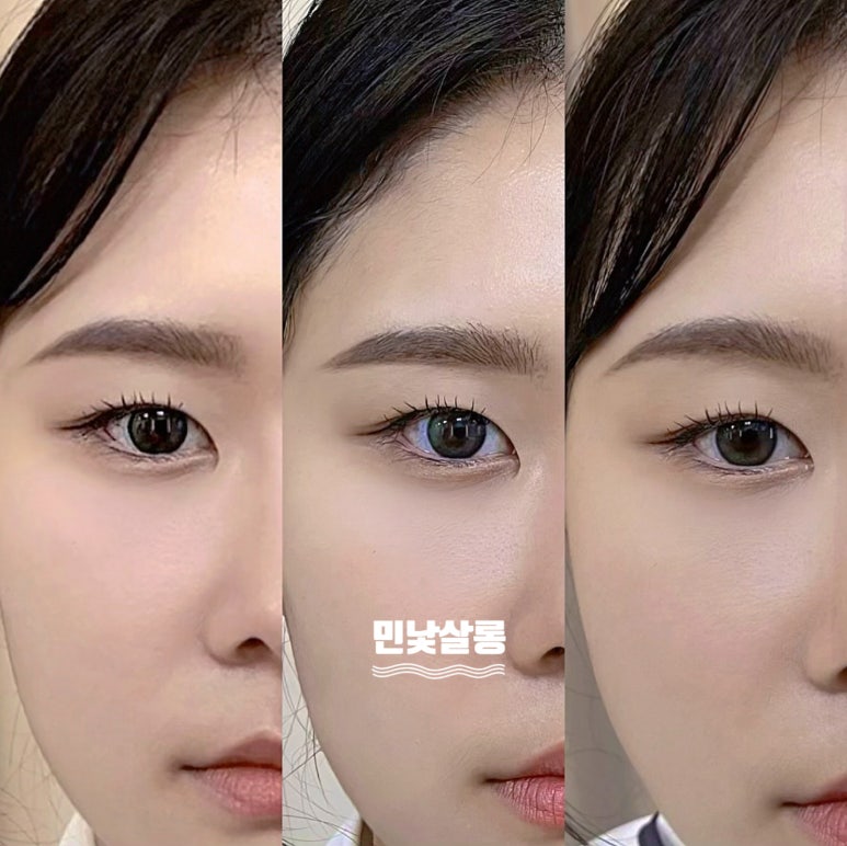 시현광택 이미지