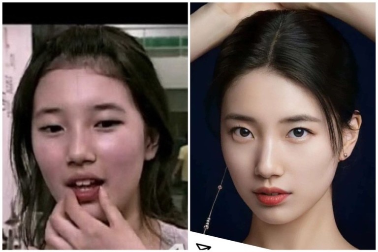 이미지헤어라인 이미지