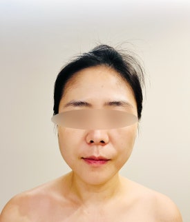 루온 에스테틱 이미지