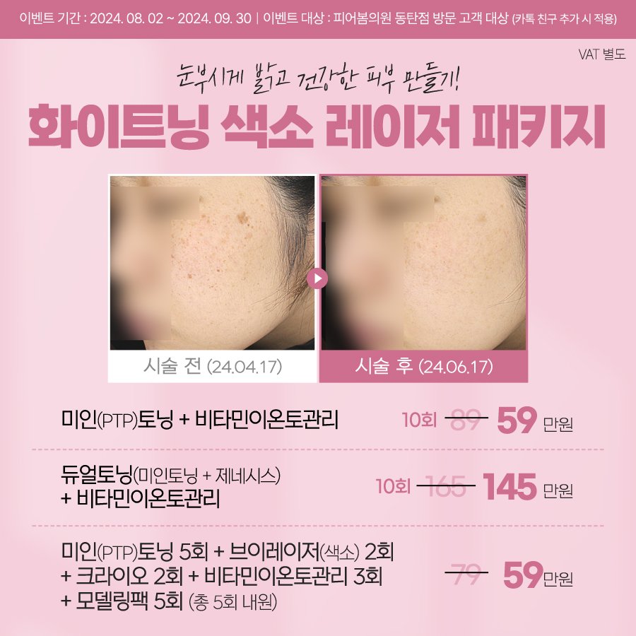 피어봄의원 이미지