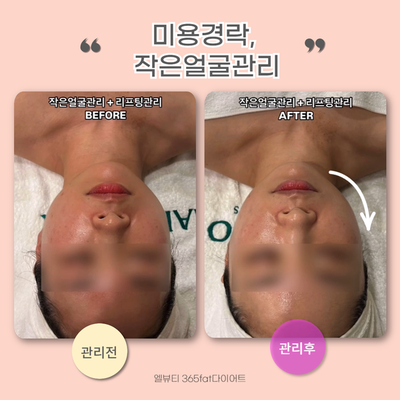 365뷰티라인 이미지