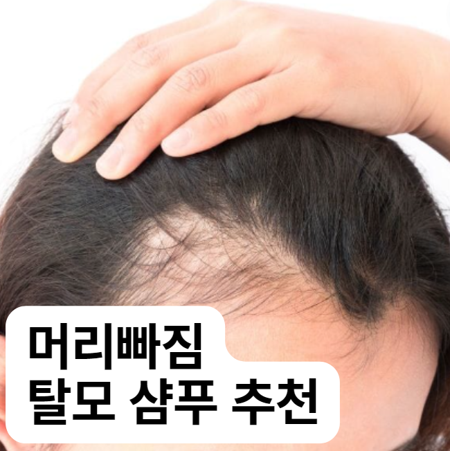 바이오바이브 이미지
