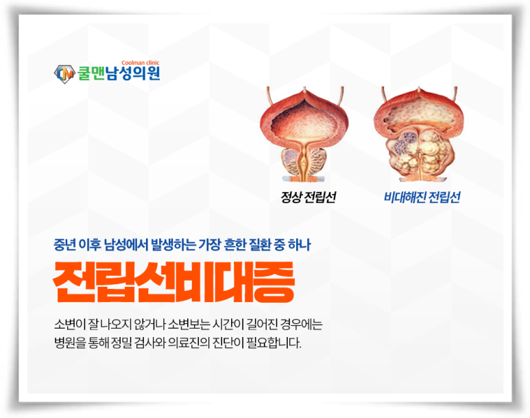 쿨맨남성의원 이미지