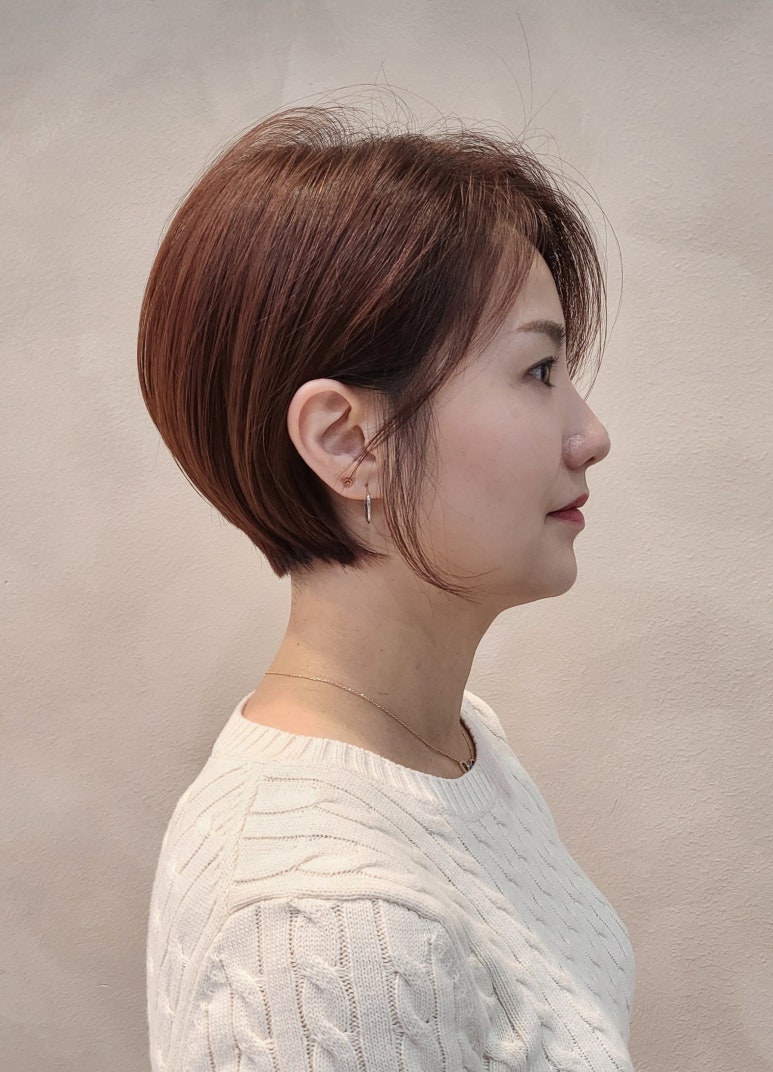마샬헤어라인 이미지