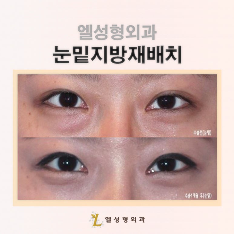엘성형외과의원 이미지
