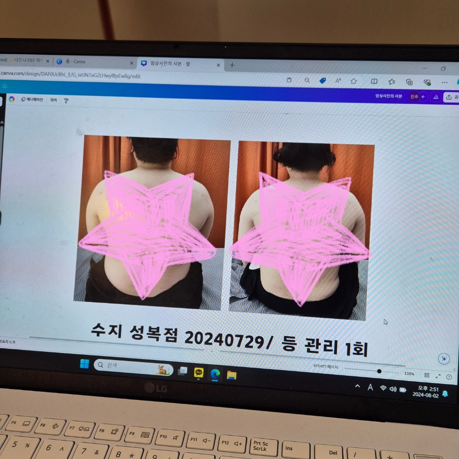 스킨바 수지성복점 이미지