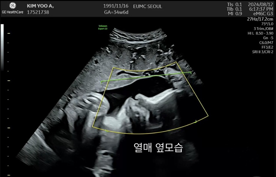 열매열무2 이미지
