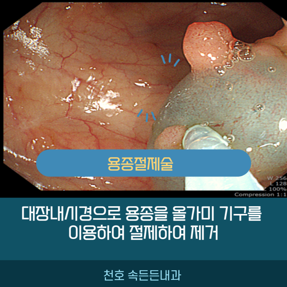 깨끗한속내과 이미지
