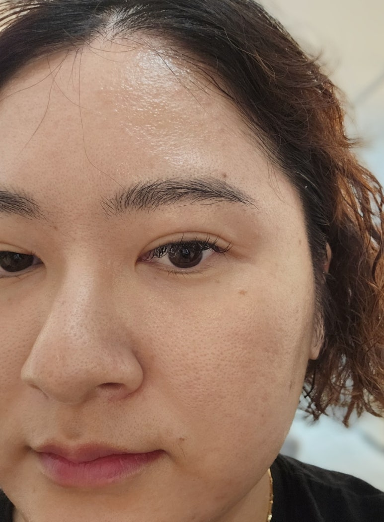 피부아지트(뉴페이스) 이미지