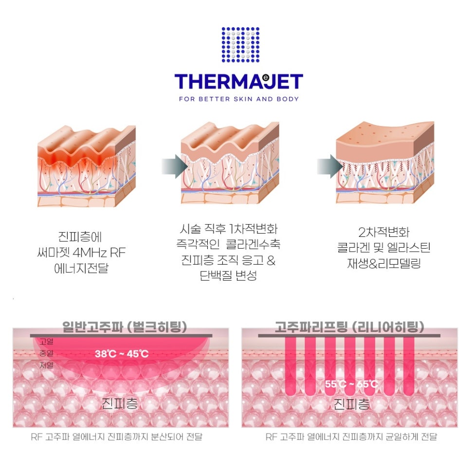 타이팅 메디케어 스킨앤바디 이미지