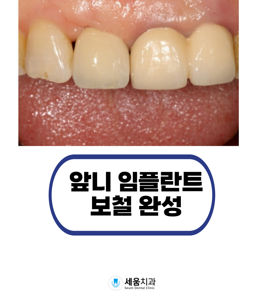 바로세움치과 이미지