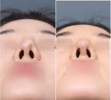 아너스티성형외과의원 이미지