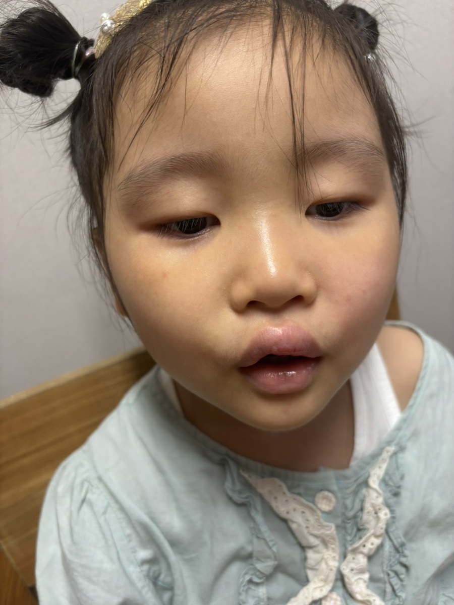 예설 이미지
