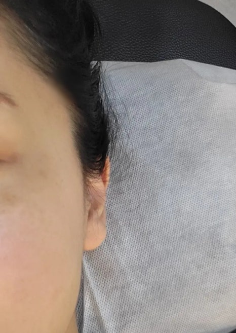 아나덴 슈가링왁싱 김포장기점 이미지