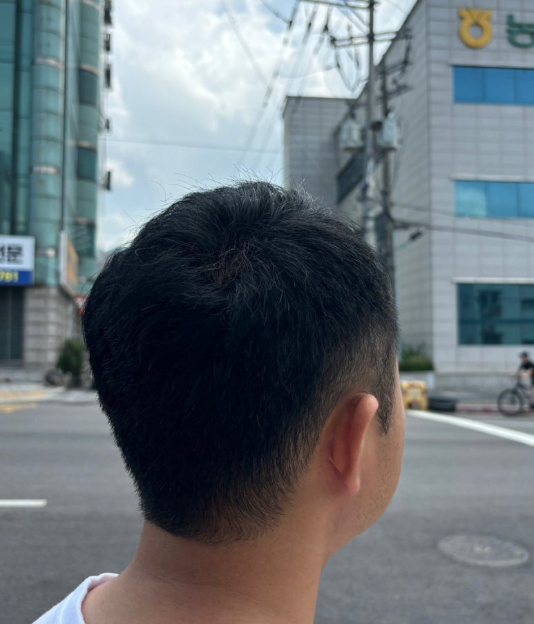 리스칼프 이미지