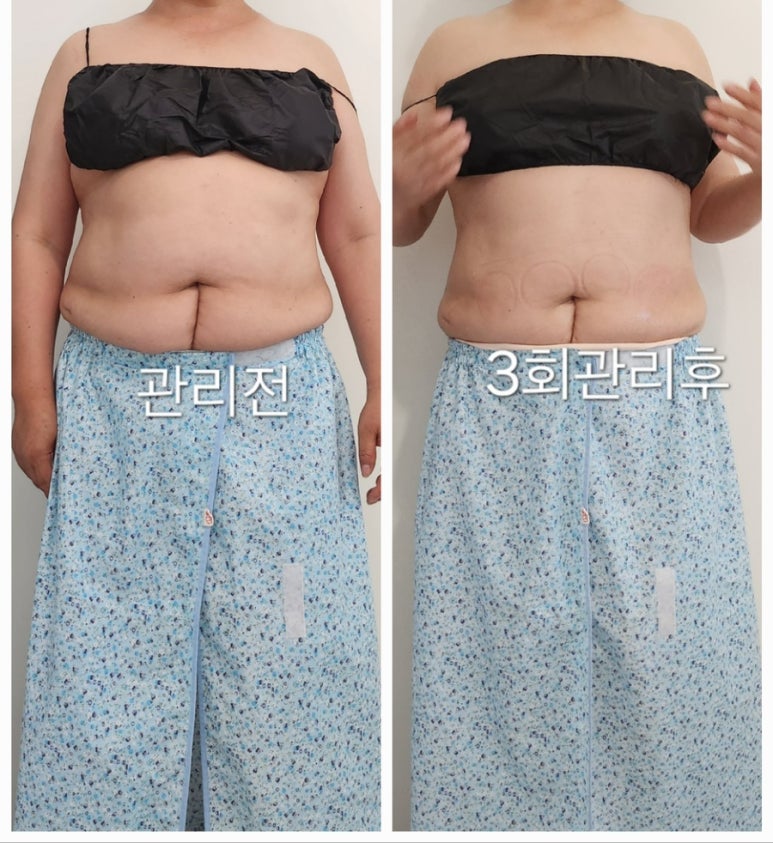 셀핏 이미지
