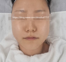 아누보스킨 이미지