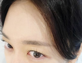 르네41 이미지