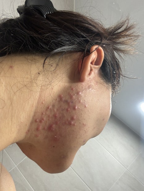 김채주스킨케어 이미지