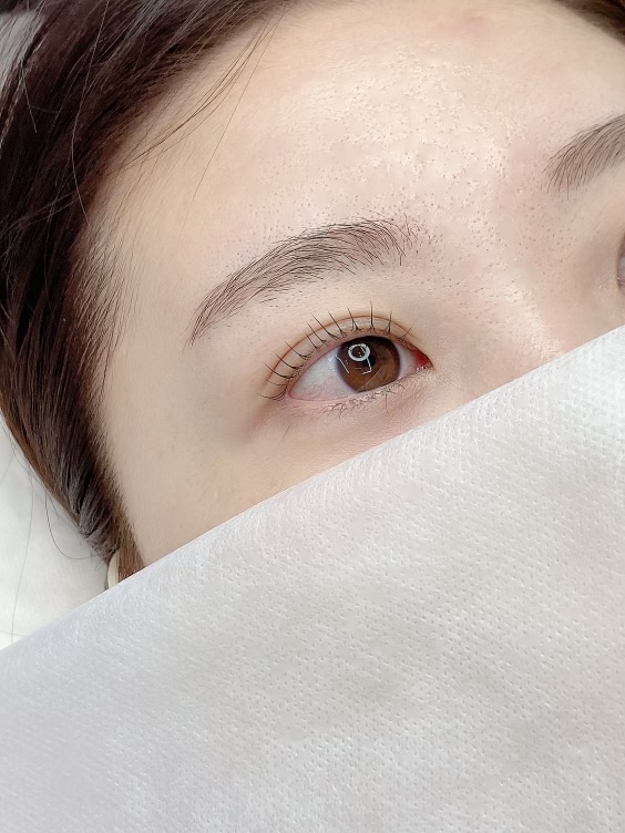 보니떼 이미지