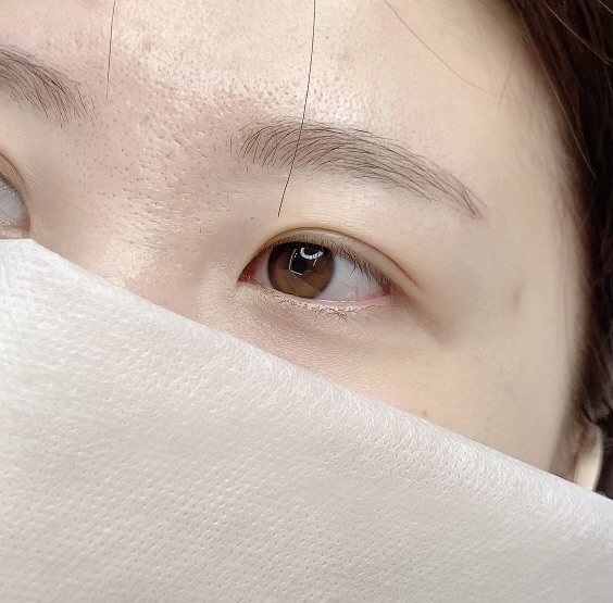 보니떼 이미지