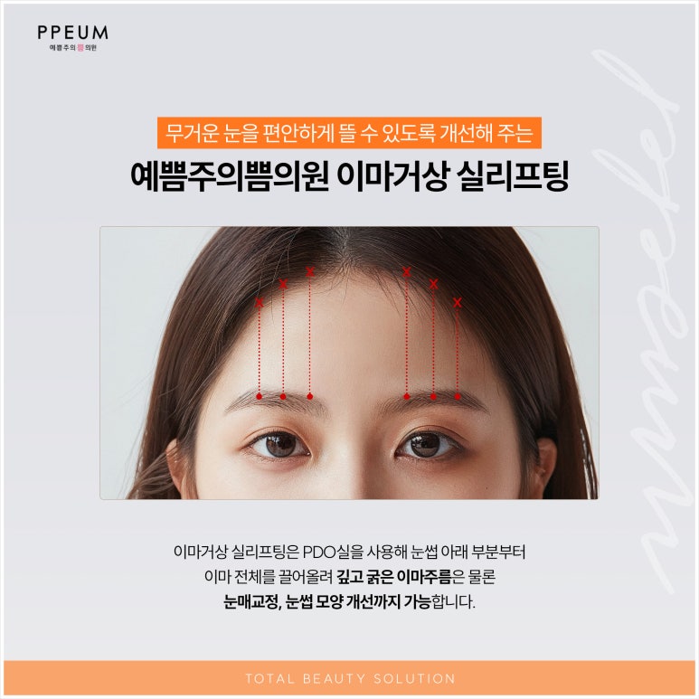 예쁨주의쁨의원 이미지