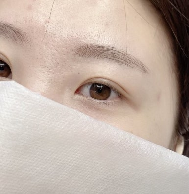 보니떼 이미지