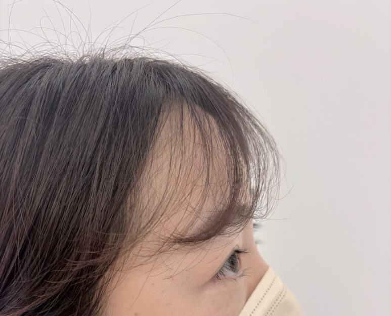 주주브로우 이미지