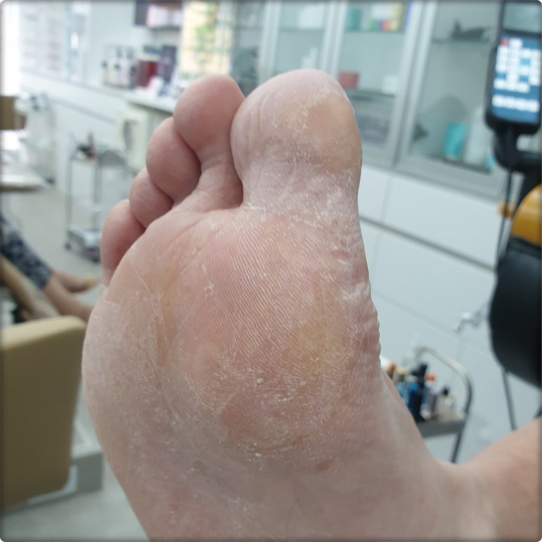 발라발라네일 이미지
