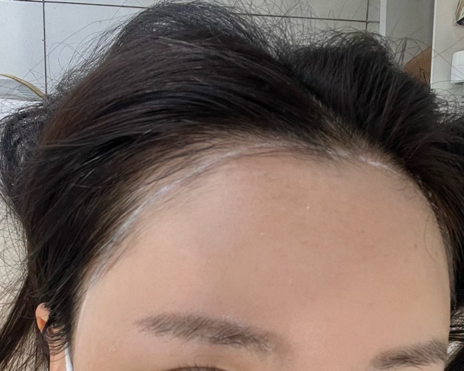 비니드헤어 이미지