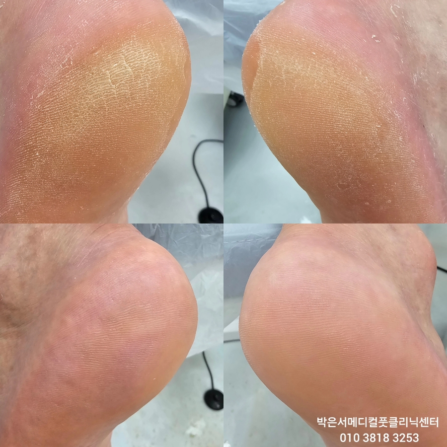 박은서메디컬풋클리닉센터 이미지