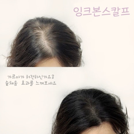 잉크본 이미지