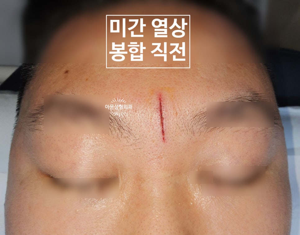 아문성형외과의원 이미지
