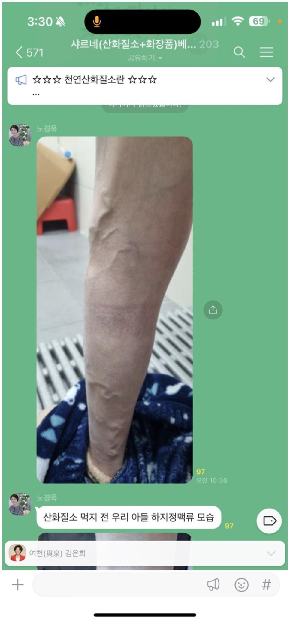 샤르네 이미지