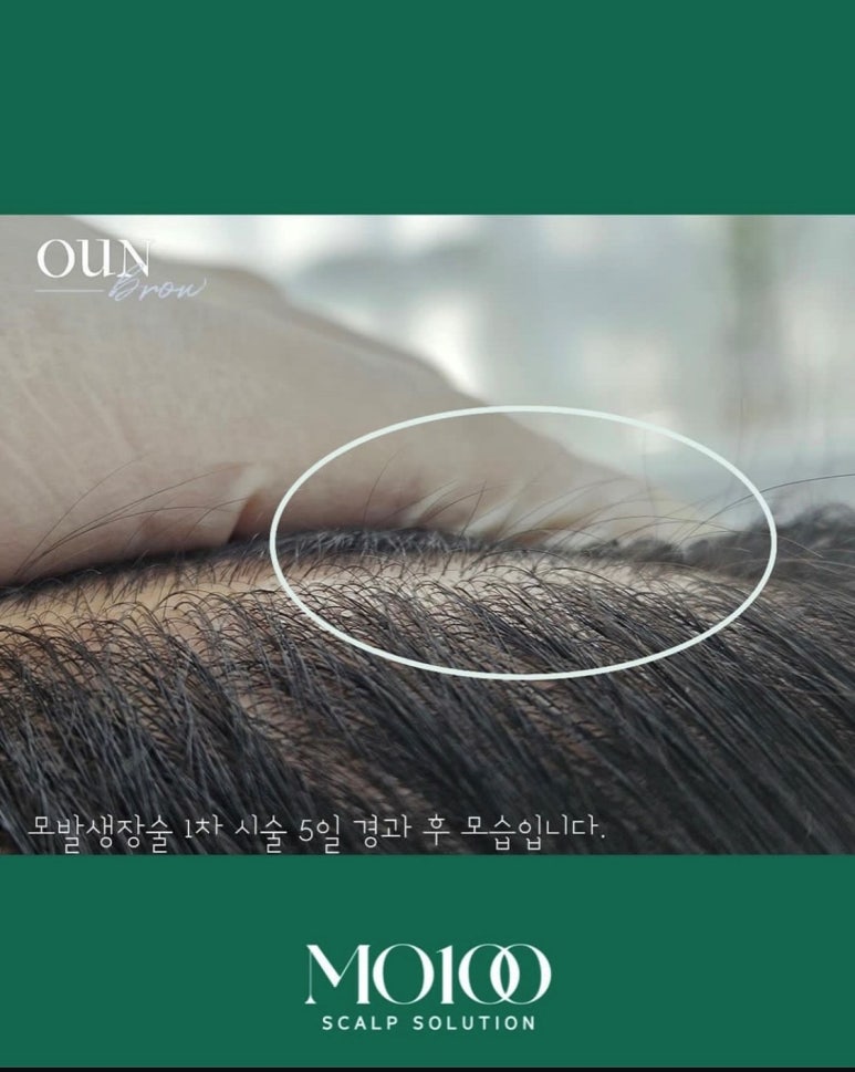 오운브로우 이미지