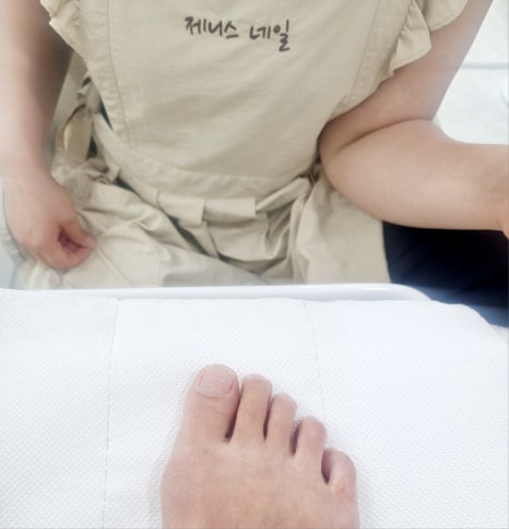 제니스네일1호 이미지