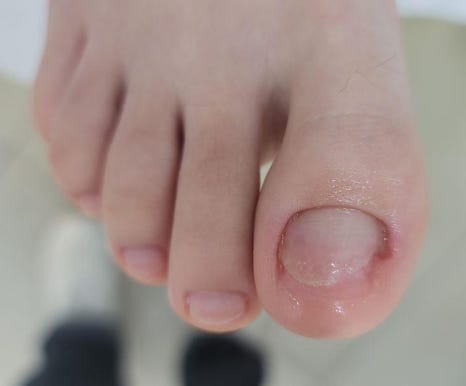 대전레푸스다솜네일 이미지